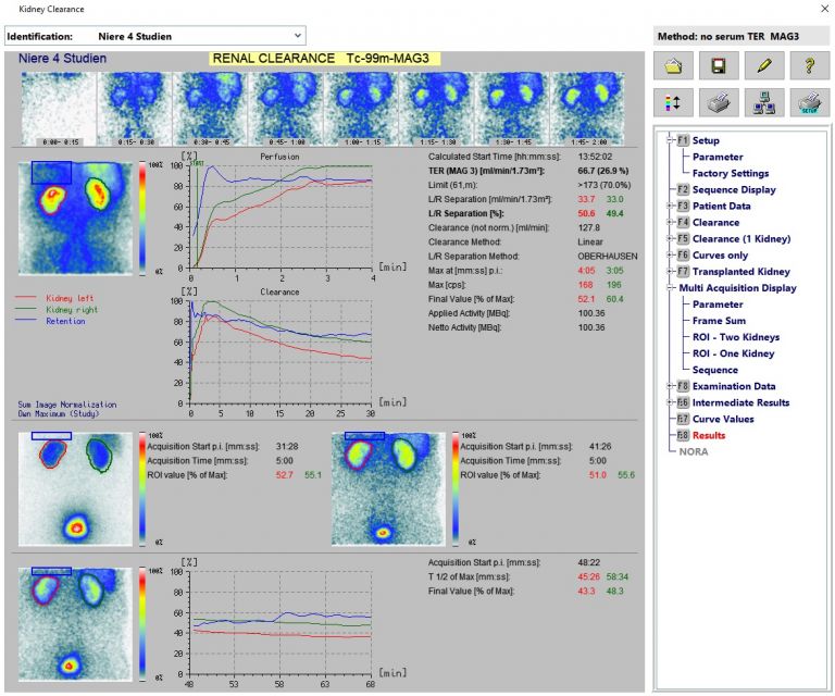 Kidney TER, GFR and ERPF calculation MiE
