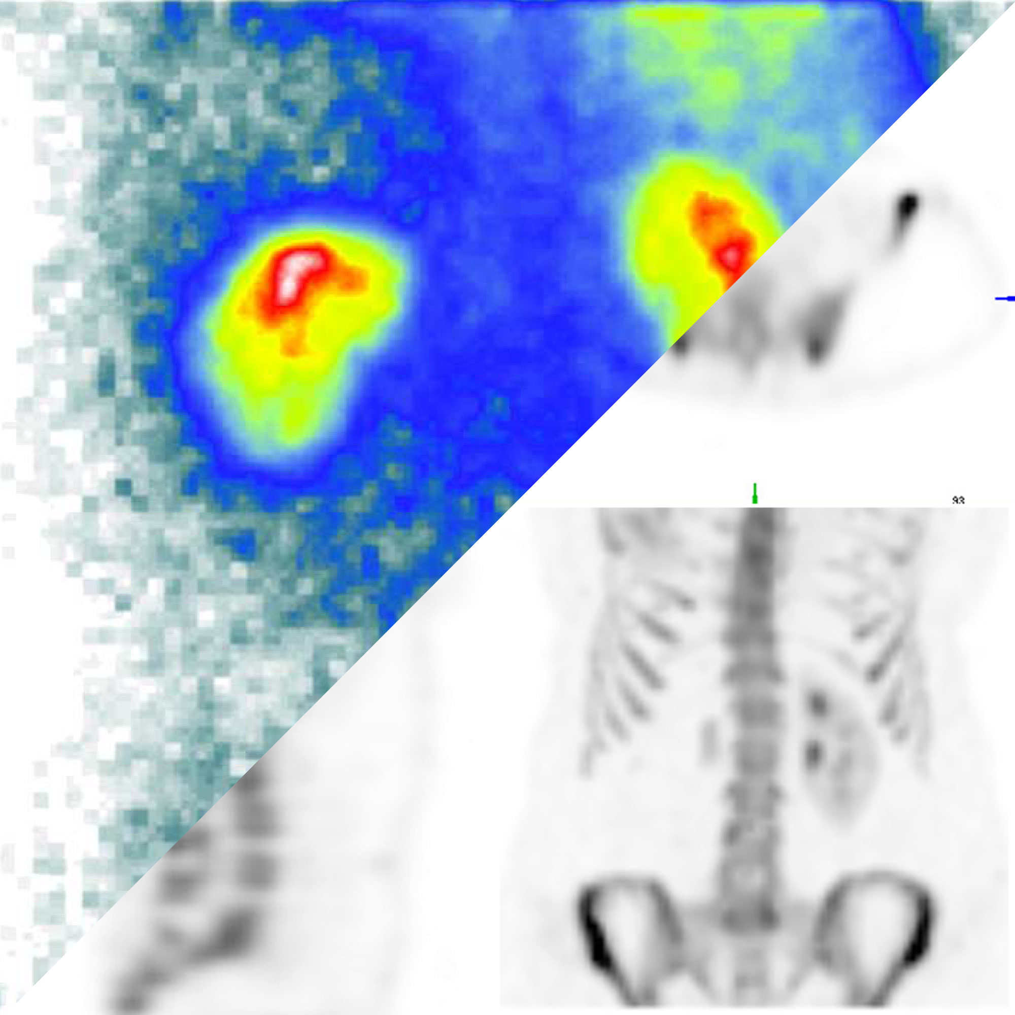 MiE medical imaging electronics