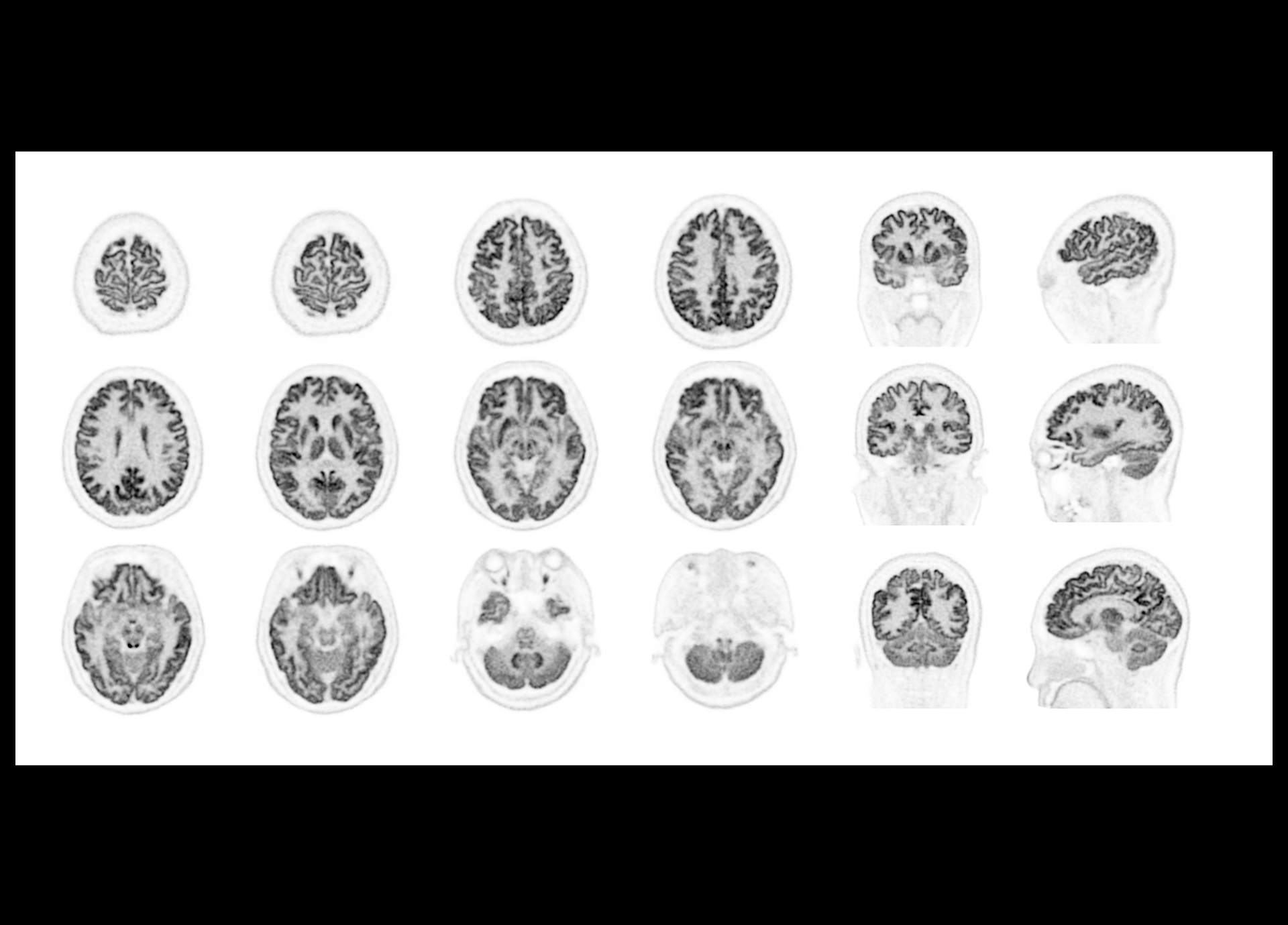 p13 High Resolution Brain Imaging positioned at edge of AFOV