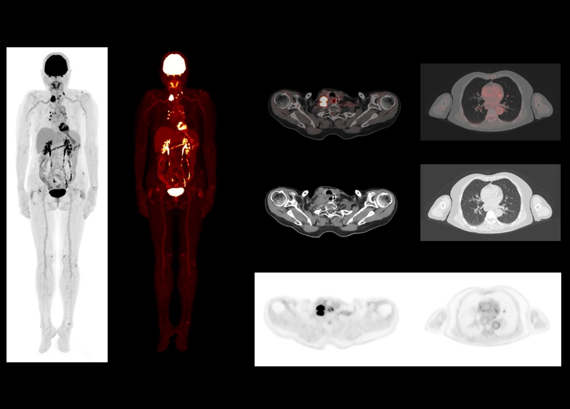 p14 3 min fast scan with low dose usage